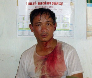 Thêm một vụ lâm tặc hung hãn chém người - 1 Thêm một vụ lâm tặc hung hãn chém người - 1