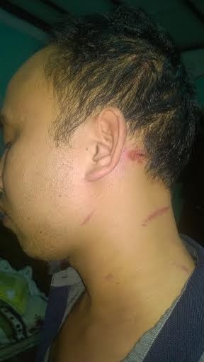 Những vết thương anh Hải tố bị hai vị Trưởng và Phó Công an xã hành hung