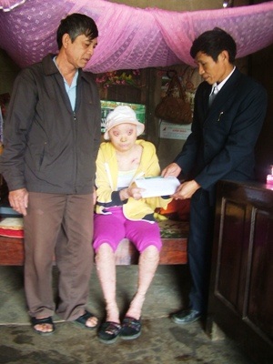 Nụ cười hạnh phúc của gia đình cô bé da cam - 2