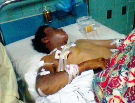 Anh T. nhập viện cấp cứu với rất nhiều vết thương trên mình