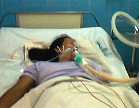 Một phụ nữ nguy kịch vì ăn cá nóc