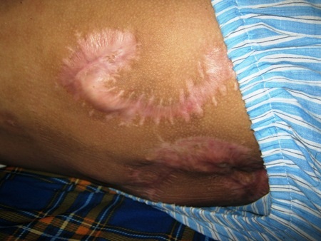 “Mẹ ơi, sao không để con chết đi”