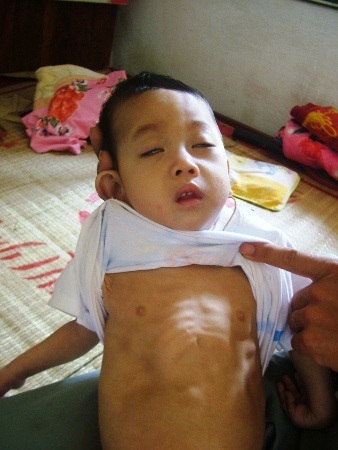 Ôm đứa con mang bệnh trên tay, anh Tâm như bất lực trước số phận