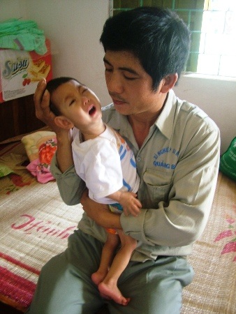 Ôm đứa con mang bệnh trên tay, anh Tâm như bất lực trước số phận