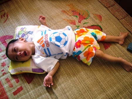 Những khi lên cơn co giật, bé Lâm khóc ngằn ngặt vì đau đớn