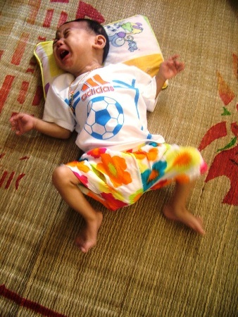 Đã hơn 1 tuổi nhưng bé Lâm chỉ nằm liệt một chỗ, không lật được