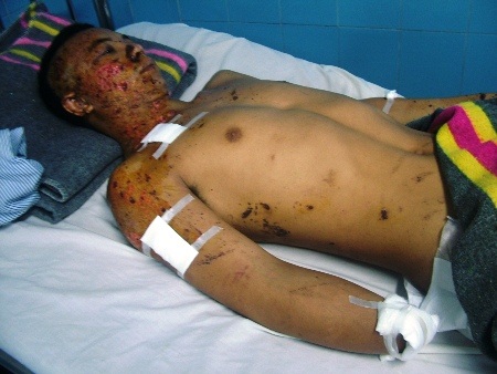 Nạn nhân đã tỉnh lại nhưng sức khỏe vẫn còn rất yếu