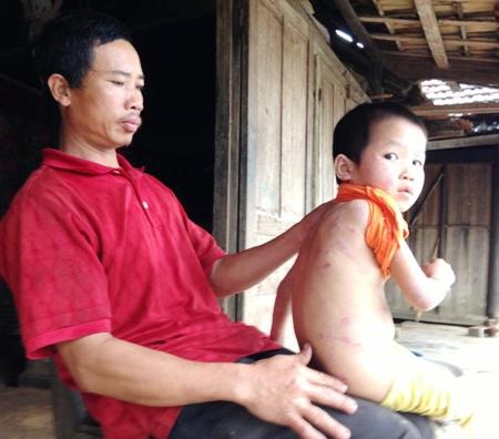 Ánh mắt vô hồn của bé Trà Giang như muốn nói lên lời cầu cứu đến tội nghiệp