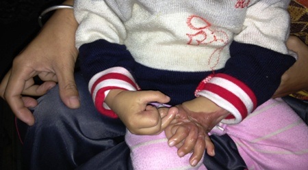 Đôi vợ chồng nghèo luôn cầu mong một phép màu sẽ đến để cứu lấy đôi tay của bé Hoàng Quân