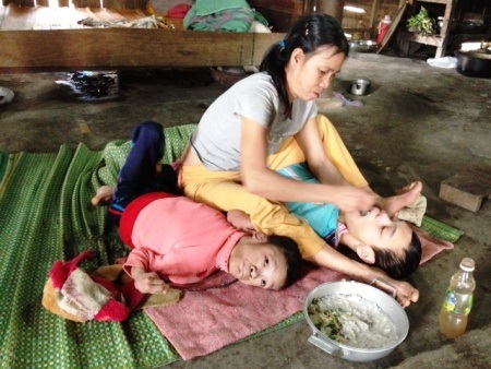 Rơi nước mắt trước bữa cơm chiều đạm bạc của 3 con người bị căn bệnh bại não hành hạ  
