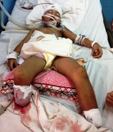 Hiện cháu Việt đang hết sức nguy kịch, cần sự chung tay giúp đỡ của cộng đồng xã hội