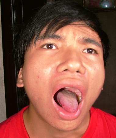 Mắc bệnh lạ, chàng sinh viên quanh năm chỉ... húp cháo thay cơm