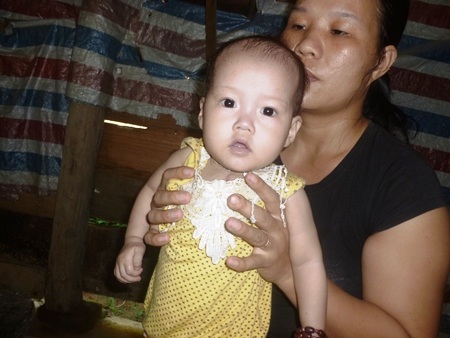 Mắc bệnh tim bẩm sinh phức tạp, sự sống bé 9 tháng tuổi hết sức mong manh - 3 Bế đứa con gái bé bỏng trên tay, chị Thiết tủi phận kể về hành trình đưa con đi chữa bệnh tứ phương