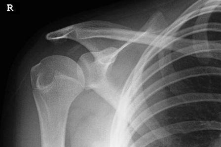 Lauren Harry ở Anh