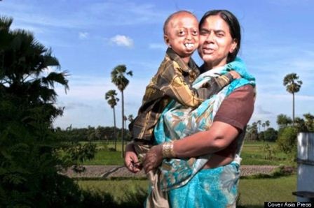 5 anh em của Ali Hussain Khan đều đã chết vì căn bệnh này