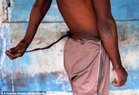 Anh Chandre Oraon lúc sinh ra đã có chiếc đuôi