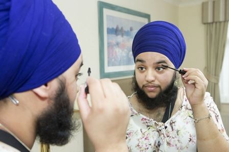 Trước khi mắc bệnh lạ, Harnaam Kaur là một cô gái xinh đẹp đầy nữ tính