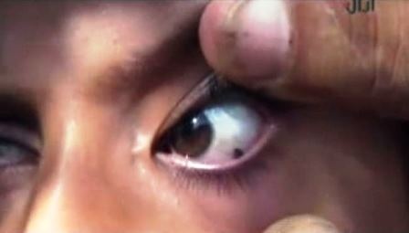 Những viên đá được hình thành từ đôi mắt của bé 