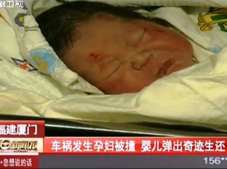 Em bé chào đời trong lúc mẹ bị xe cán qua người vẫn khỏe mạnh - 2 Em bé chào đời trong lúc mẹ bị xe cán qua người vẫn khỏe mạnh