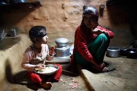 Thăm gia đình “người sói” ở Nepal - 4 Manjura ngồi cạnh em gái của mình trong lúc ăn cơm trưa tại nhà