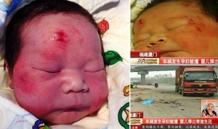 Em bé chào đời trong lúc mẹ bị xe cán qua người vẫn khỏe mạnh - 1 Em bé chào đời trong lúc mẹ bị xe cán qua người vẫn khỏe mạnh