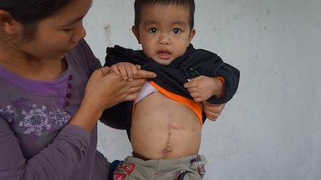 Cháu Nhật Tiến đã được phẫu thuật.