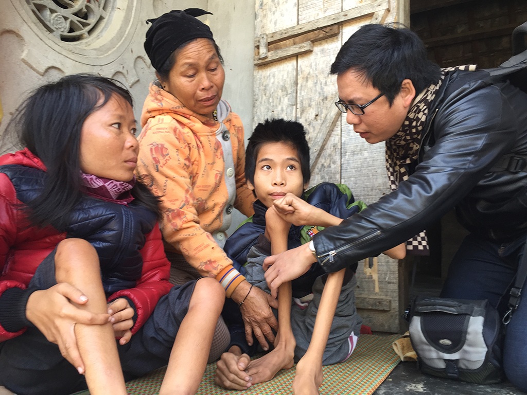 Hai chị em gầy guộc mong một lần được đi khám viện - 2 Chân tay Giót và chị gái bị tương tự nhau.