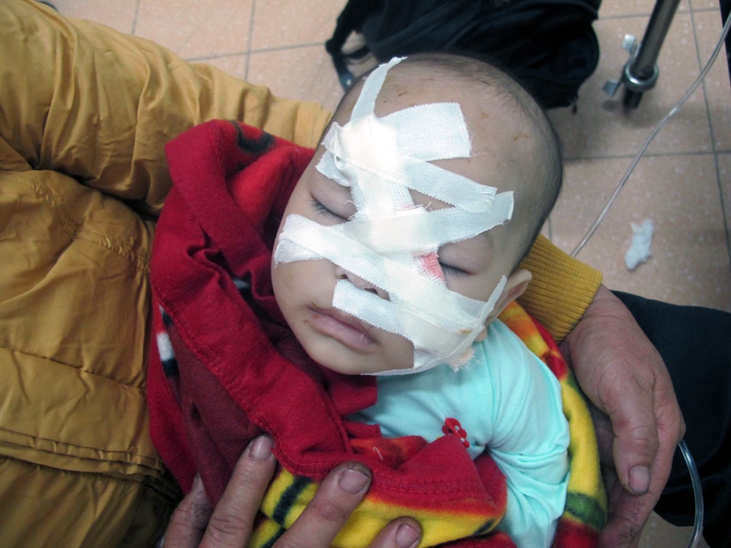 Hiện sau khi cấp cứu, cháu Linh đã được các bác sỹ BV Sản - Nhi Nghệ An phẫu thuật.