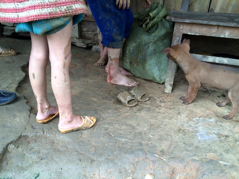 Ngập ngụa trên con đường đau khổ nhất miền Tây xứ Nghệ - 9 Nhiều em sau khi lội bùn chân đã bị tứa máu.