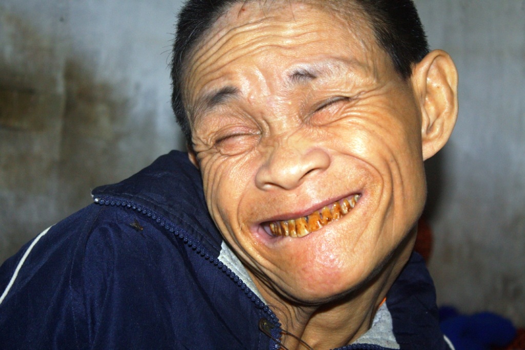 Thương người đàn ông với nụ cười... "khó coi" - 1 Thương người đàn ông với nụ cười... khó coi