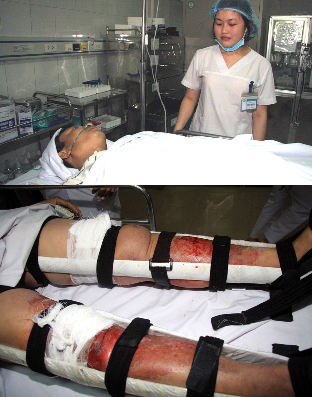 Điều dưỡng viên, sinh viên hiến máu cứu người bị nạn