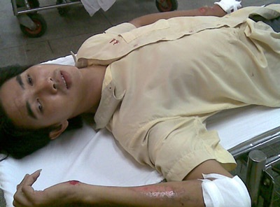 Bị cướp chống trả, một “hiệp sĩ” nhập viện - 1 Bị cướp chống trả, một “hiệp sĩ” nhập viện - 1