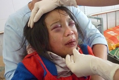 Bắt khẩn cấp cha nuôi hành hạ dã man bé gái 10 tuổi - 2 Bắt khẩn cấp cha nuôi hành hạ dã man bé gái 10 tuổi - 2