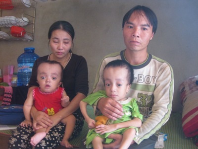 Nghị lực phi thường của cậu bé mắc bệnh não úng thủy - 1 Gia đình Ngọc sống tạm vào chiếc chòi tạm bên đường