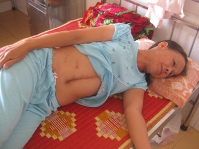 Ngặt nghèo người phụ nữ đơn thân chật vật sau cơn bạo bệnh - 2 Hiện, một mình bà phải đơn độc chống chọi với bệnh tật và sức khỏe ngày càng yếu