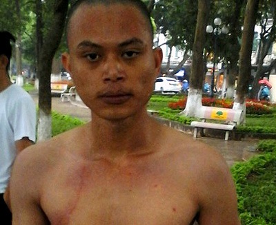 “Ngáo đá”, nam thanh niên bơi ra tháp Rùa tìm… nàng tiên cá - 1 Đối tượng phê đá Nguyễn Thế Công