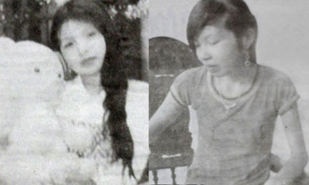 Cô gái 5 năm không ăn cơm, chỉ ăn hoa quả - 1 Nguyễn Thị Tuyến trước (ảnh trái) và sau khi mắc căn bệnh kỳ lạ.