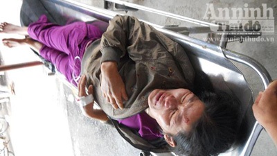 Nổ đường dây điện, một người nhập viện - 3 Sau khi bị nổ dây điện rơi xuống đường tiếp tục cháy đun chảy nhôm, vỏ nhựa lẫn nhựa đường.