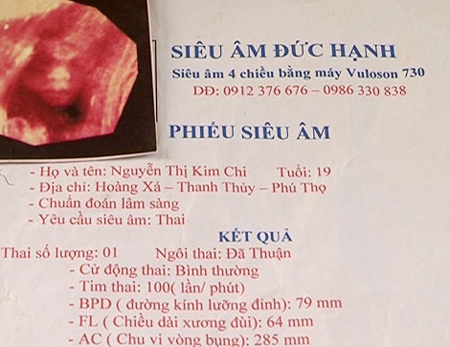 Sự thật đằng sau vụ án bắt cóc thai phụ tống tiền - 2 Tờ kết quả siêu âm được làm giả.
