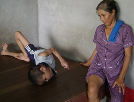 Những người mẹ cả đời cơ khổ vì con - 1 Gần 20 năm qua, cô To
chưa 1 lần từ bỏ hy vọng chữa khỏi chứng co gồng quái ác cho con