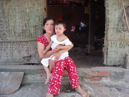 Bé Uyển Nhi bị bạch cầu tủy cấp, phải vào hóa chất định kỳ để chữa trị