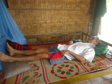 Bé Uyển Nhi bị bạch cầu tủy cấp, phải vào hóa chất định kỳ để chữa trị