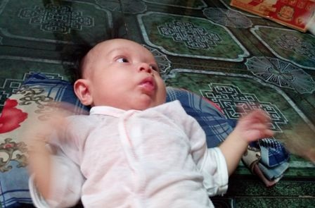 Bé gái 5 tháng tuổi khốn khổ với đủ thứ bệnh hành hạ cơ thể - 1 Bé gái 5 tháng tuổi khốn khổ với đủ thứ bệnh hành hạ cơ thể
