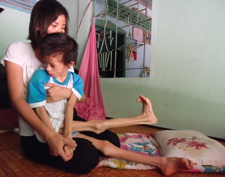 Chỉ sau vài cơn sốt nhẹ, bé Nhật Lam bị tê liệt toàn thân, sống đời thực vật