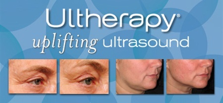 Liệu pháp nâng cơ, căng da 1 lần duy nhất - 3 Trước và
sau điều trị với công nghệ Ultherapy.