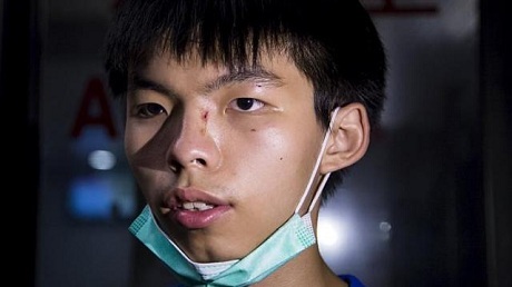 Thủ lĩnh biểu tình Joshua Wong bị hành hung - 1 Thủ lĩnh sinh viên của phong trào biểu tình đòi bầu cử tự do Hồng Kông Joshua Wong. (Ảnh:
