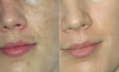 Dưỡng trắng chống lão hóa với Collagen và sữa ong chúa - 4 - S