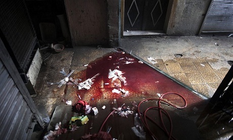 Một phụ nữ bị thương bước ra từ bệnh viện Dar El Shifa ở thành phố Aleppo, Syria.