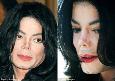 Phát hiện bất thường trong cái chết của Michael Jackson - 2 Phát hiện bất thường trong cái chết của Michael Jackson