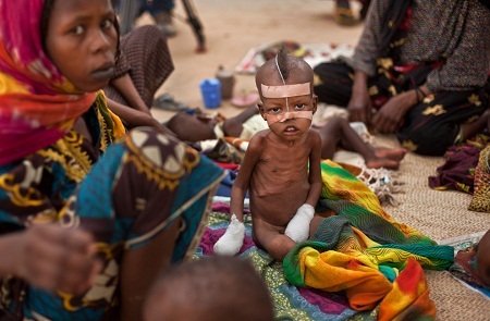 Cậu bé người Somali trong trại tị nạn ở Kenya nhìn người mẹ ốm yếu của mình.
